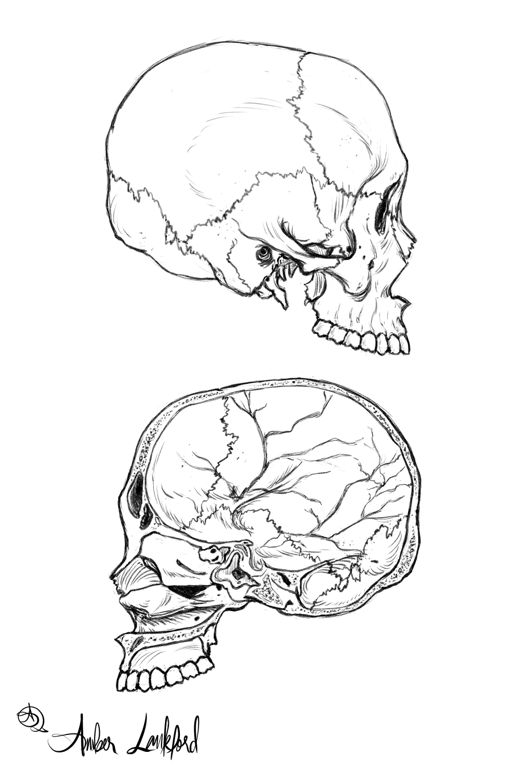 Skull, Lateral views